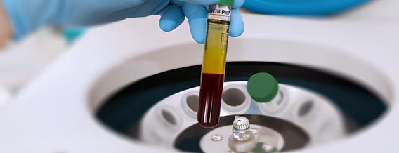 Image of medical centrifuge